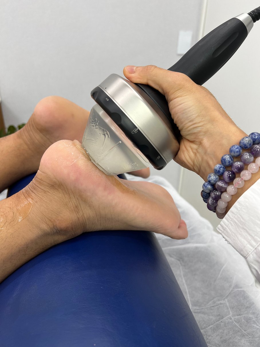 Visão detalhada de terapia por ondas de choque sendo aplicada em paciente com fasciite plantar para alívio de dor no calcanhar, tratamento eficaz na clínica @medicodor
Tratamento de dor crônica
médico fisiatra
dor no pé
esporão calcaneo
dor pisada